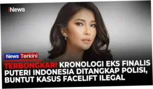 Eks Finalis Puteri Indonesia Ditangkap karena Facelift Ilegal