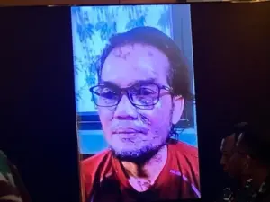 Foto Luka Wajah Terdakwa Penyiram Air Keras ke Andrie Yunus Ditampilkan di Sidang