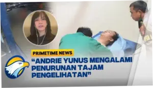 Andrie Yunus Jalani Fisioterapi, Kondisinya Membaik Setelah Disiram Air Keras
