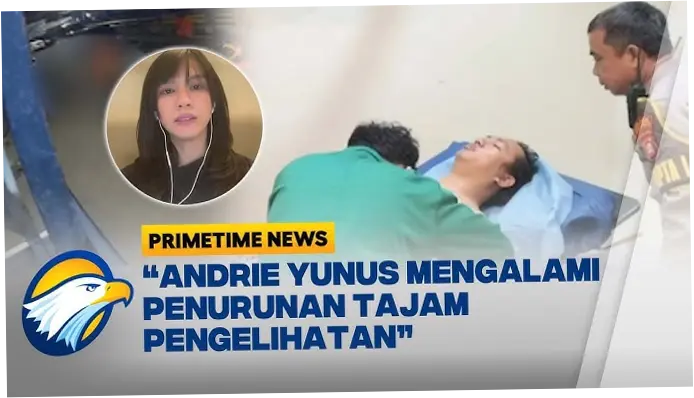 Andrie Yunus Jalani Fisioterapi, Kondisinya Membaik Setelah Disiram Air Keras